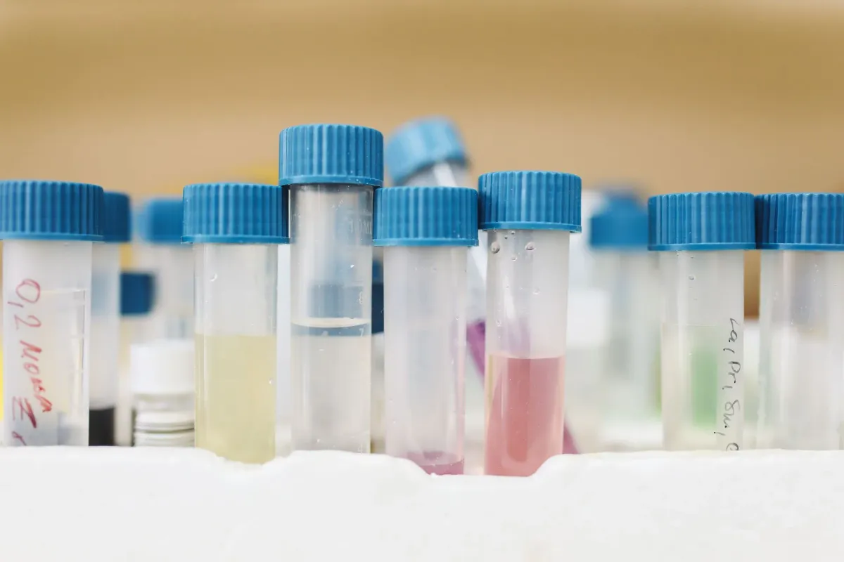 Tubos de coleta com tampas azuis numa bancada de laboratório